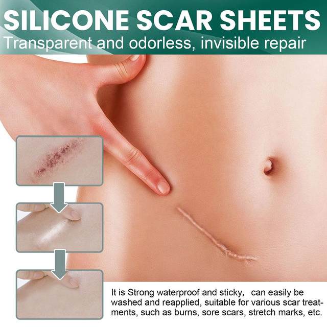 GlowOasis Silicone Scar Sheets