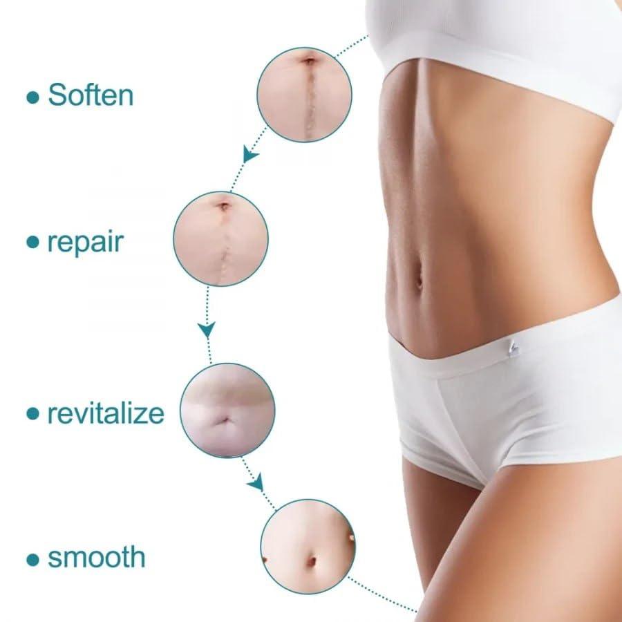 GlowOasis Silicone Scar Sheets