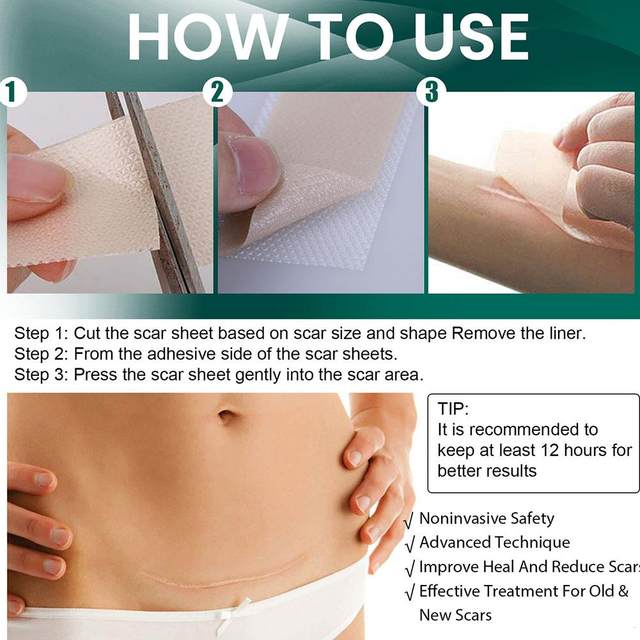 GlowOasis Silicone Scar Sheets