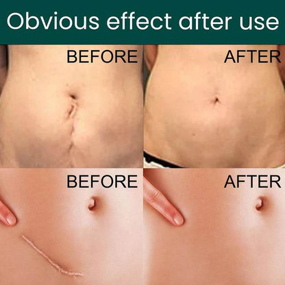 GlowOasis Silicone Scar Sheets